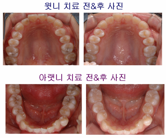 e-플랜트치과 이미지