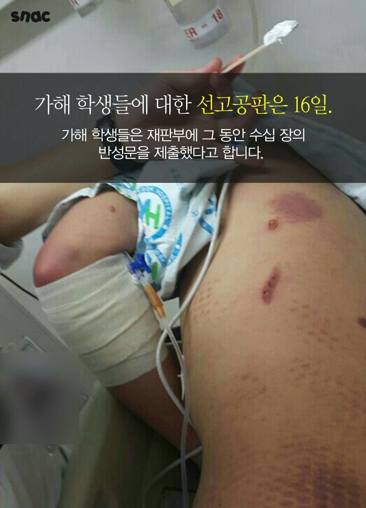 천안의 지적장애폭행 공포의34시간 (분노주의) | 인스티즈