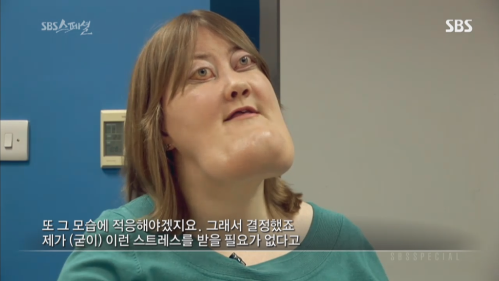 기형적 턱을 가진 여자 비키 라이트가 성형수술을 하지 않는 이유 | 인스티즈