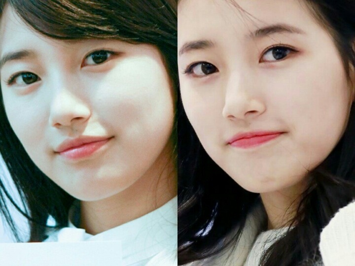 성형 절대로 안한 수지 | 인스티즈