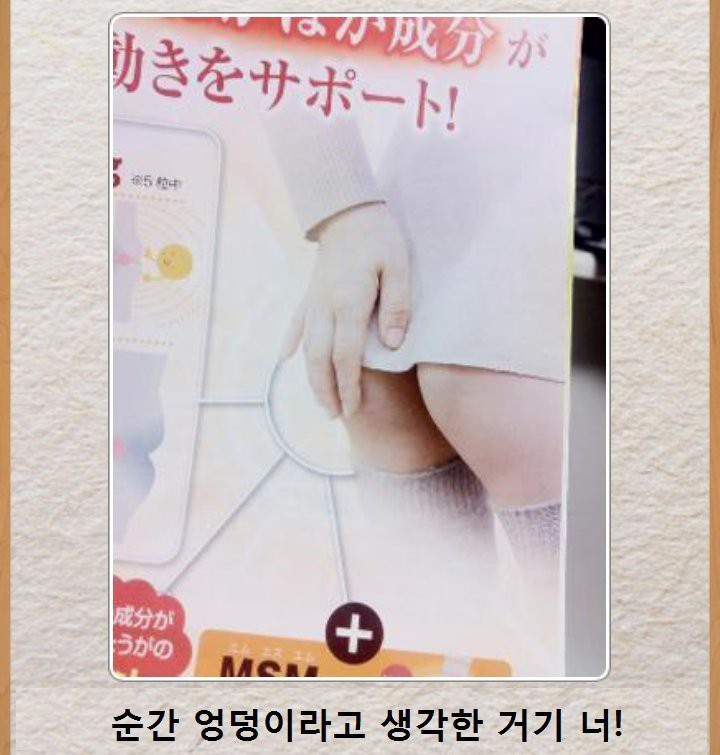 엉덩이가 보이면 일상생활 불가능 | 인스티즈