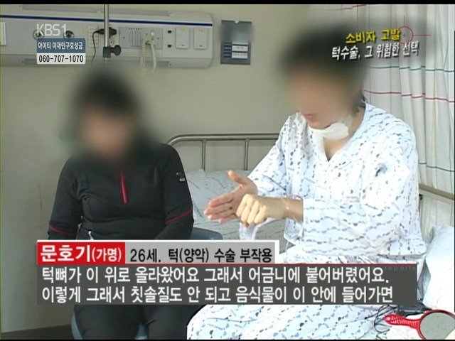 성형외과 종사자들이 말하는 부작용 위험높은 수술 쓰리톱 (혐오주의) | 인스티즈