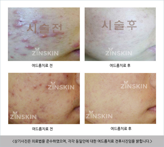복피부과 이미지