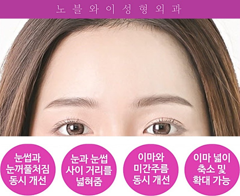 더노블성형외과의원 이미지