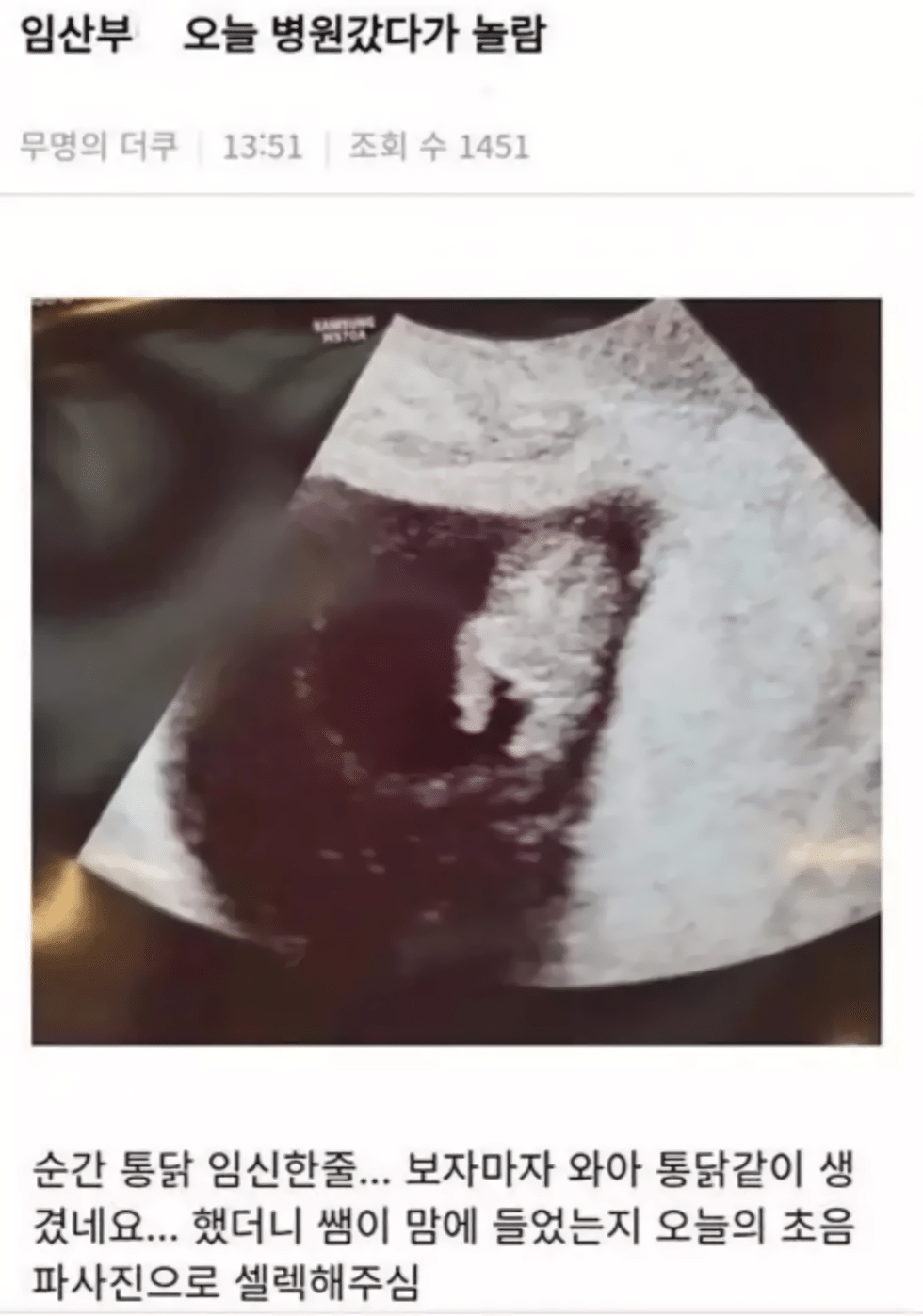 통닭을 임신한 임산부.jpg | 인스티즈