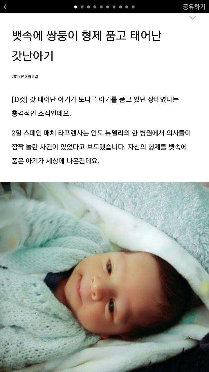 뱃속에 쌍둥이 형제 품고 태어난 갓난아기 | 인스티즈