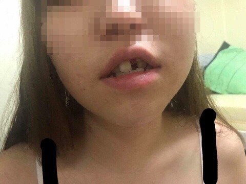 내 지인이 남자친구한테 폭력당했어 좀 도와줘 ((페이스북)) | 인스티즈