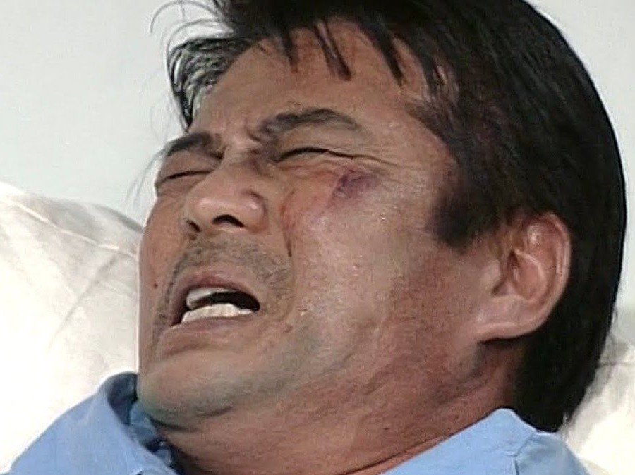 고자들로 이루어진 기마부대.jpg | 인스티즈