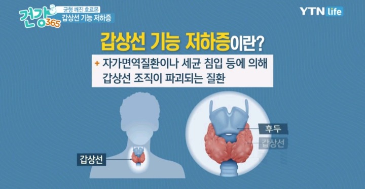 살이찌고 피곤하다면 갑상선 저하증 의심.jpg | 인스티즈