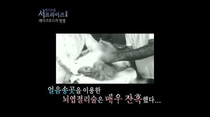[서프라이즈] 잘못된 수술 레이크우드의 망령.jpg | 인스티즈