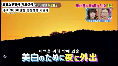 프랑스 인형이 되고싶어 총액 3000만엔 전신성형한 바닐라 | 인스티즈