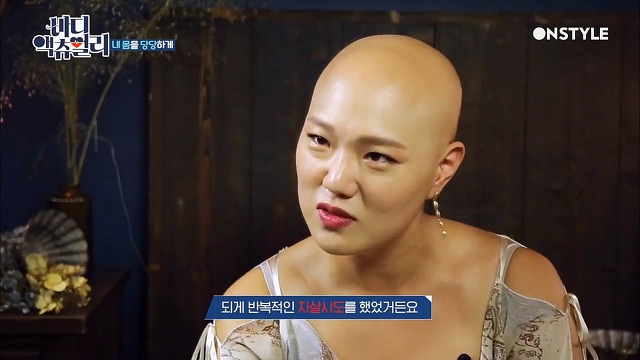 전신탈모증 윤사비나씨가 생각하는 아름다움.jpg | 인스티즈